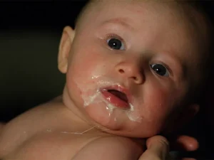 رفلاکس نوزادان