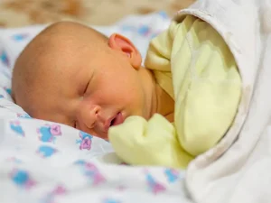 زردی نوزادان