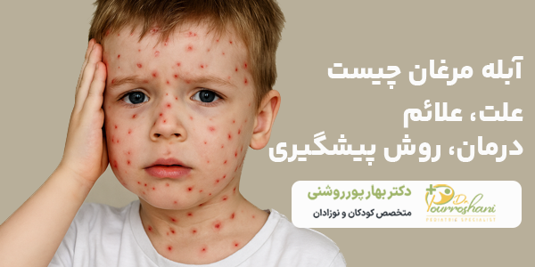 علت آبله مرغان چیست