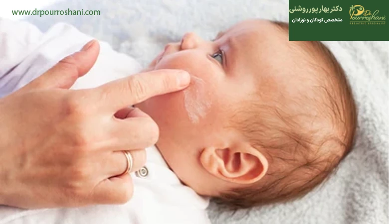 انواع حساسیت پوستی در نوزادان