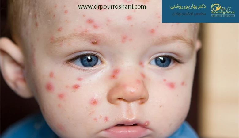 جهت درمان بیماری های شایع کودکان به چه دکتری مراجعه کنیم