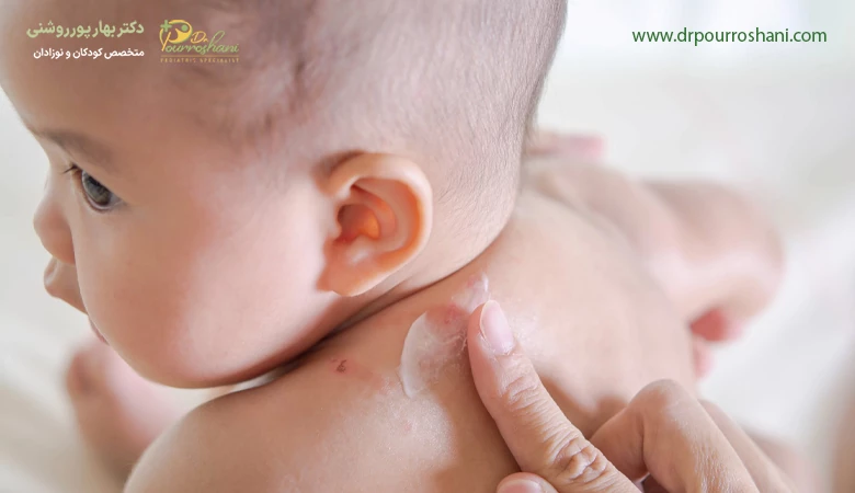 حساسیت پوستی در نوزادان چیست؟