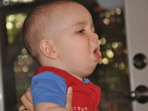 خس خس سینه کودکان چیست؟