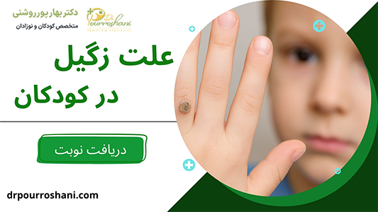 علت زگیل در کودکان