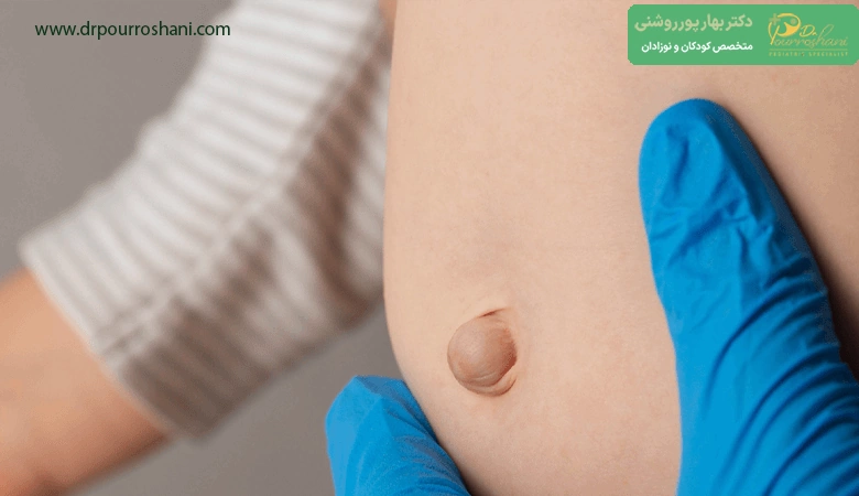 علل فتق در کودکان