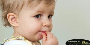 تاول پوستی در کودکان
