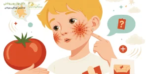 حساست به گوجه در کودکان