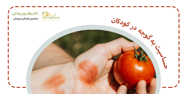 حساست به گوجه چیست