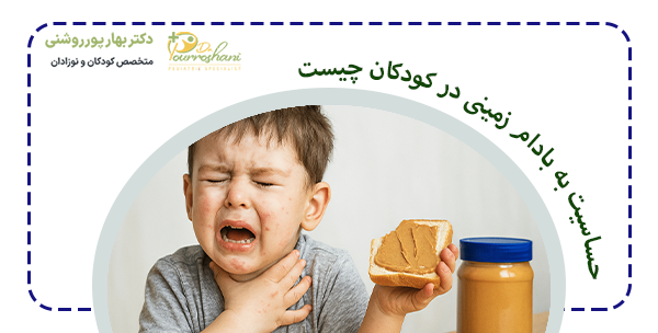 علت حساسیت به بادوم زمینی در کدوکان